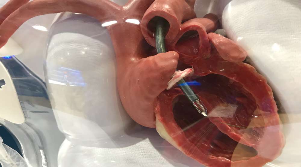 Impella Heart Pump Claims